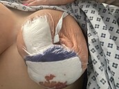 Takto dopadlo levé prso pornohereky Sophie Anderson.
