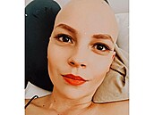 Patricia Janeková chce ukazovat pravdu o boji s rakovinou.