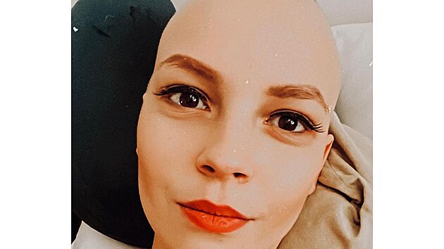 Patricia Burda Jane�ková prohrála sv�j boj s rakovinou. Bylo jí pouhých 25 let.