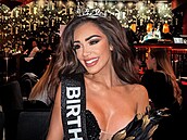 Veronica Biasol odtajnila, �e trpí nemocí vitiligo.