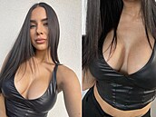 Bára St�íteská si nechala vylep�it hrudník.