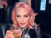 Madonna se hodn� zm�nila. Napuchlý obli�ej není zásluhou alkoholu, ale skalpelu...