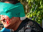 Civilistovi, kterému po tvái stéká krev, obvazuje léka hlavu poté, co byl...