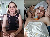 Monika byla usmvavá dívka. Pak jí lékai nali na mozku dva nádory.