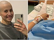 Kateina Furch bojuje s rakovinou.