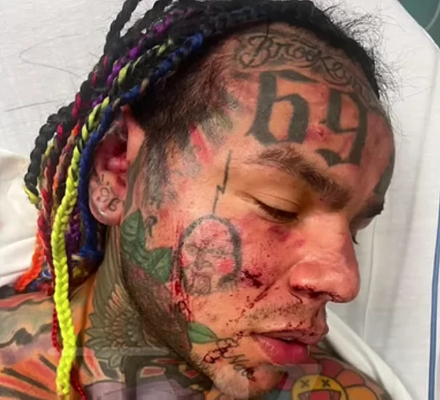 Tekashi 6ix9ine byl zbitý v tlocvin