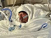 Mason Dark se lé�í s popáleninami