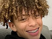 Mason Dark se lé�í s popáleninami