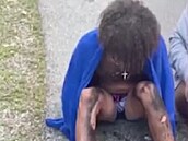 Mason Dark se lé�í s popáleninami