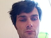 Matou� Kaluba skon�il v lé�ebn�. Expersu popsal, co se stalo.