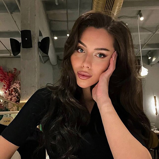 Vlada Antropova le v kmatu pot, co la na plastiku nosu.