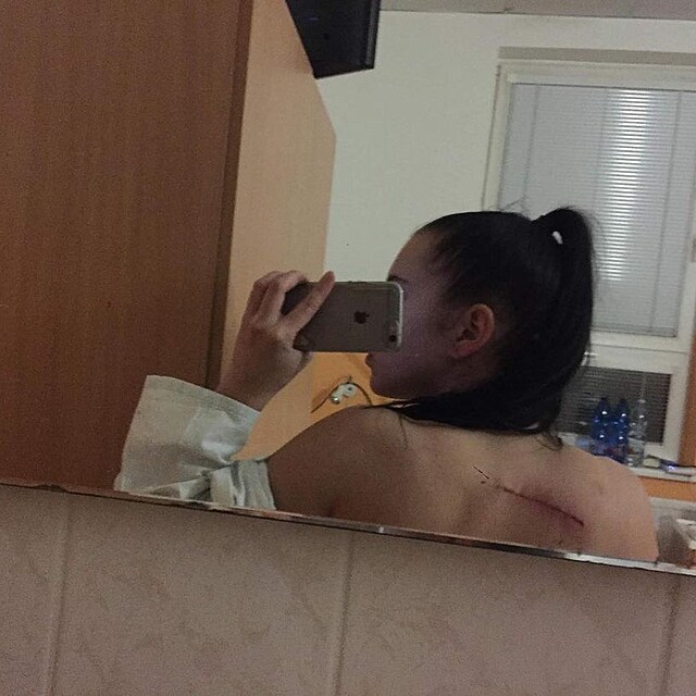 Kristna po prvn operaci