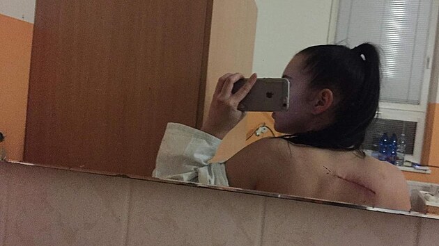 Kristýna z Brna bojuje se zákenou rakovinou ke.
