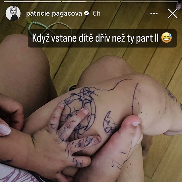 Patricie Pagov se pochlubila bezbolestnm tetovnm, kter vytvoila jej...