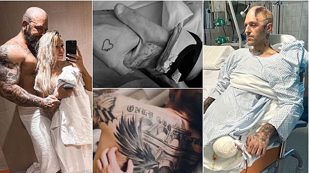 �tefan Bazso bojuje o �ivot.