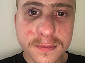 Maxgreen ml být napaden.