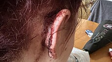 R�chel Karn�ov� ned�vno obvinila sv�ho expartnera z dom�c�ho n�sil�, zn�siln�n� i alkoholismu. Na soci�ln�ch s�t�ch sd�lela sn�mek natr�en�ho ucha.