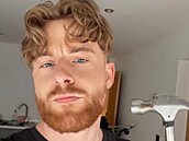 Bizarní TikTok trend, ve kterém se u�ivatelé mlátí kladivem do obli�eje.