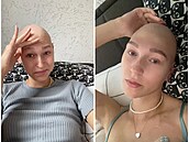Mladá dívka natá�í videa o �ivot� s leukémií