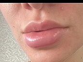 Zku�enosti po�kozených s klinikou Bratz Institute