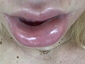 Zku�enosti po�kozených s klinikou Bratz Institute