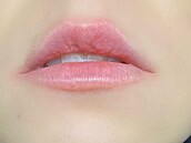 Zku�enosti po�kozených s klinikou Bratz Institute