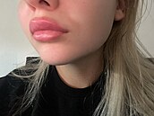 Zku�enosti po�kozených s klinikou Bratz Institute