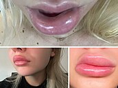 Zku�enosti po�kozených s klinikou Bratz Institute