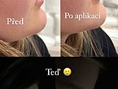 Zku�enosti po�kozených s klinikou Bratz Institute