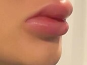 Zku�enosti po�kozených s klinikou Bratz Institute