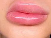 Zku�enosti po�kozených s klinikou Bratz Institute