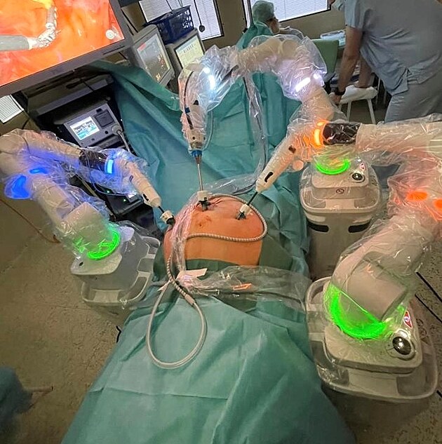 SurGal provd prvn chirurgick robotick operace systmu Versius