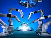 SurGal provádí první chirurgické robotické operace systému Versius