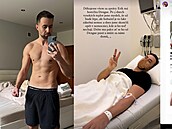 Erik Meldík má hore�ku Dengue