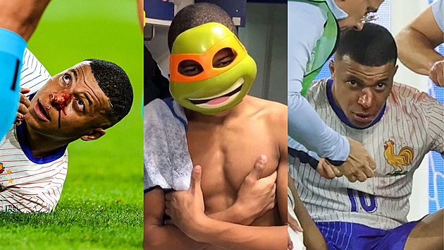 Mbappé musí kvůli zranění po zbytek mistrovství nosit masku. Podle lidí si má vzít masku Želv Ninja
