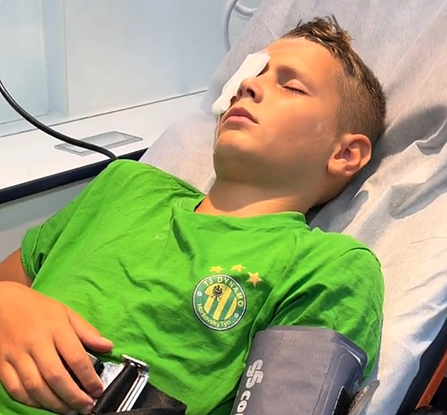 Chlapec si zasekl rybářský háček do oka. Lidé mu na TikToku vyjadřují podporu, nikdo neví, zda bude v pořádku