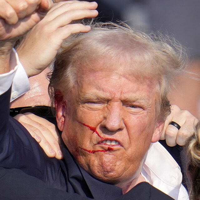Bval prezident Donald Trump s krvavou tv a zrannm na pravm uchu po...