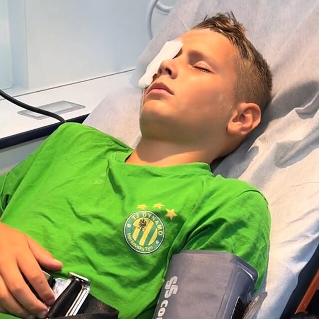 Chlapec si zasekl rybsk hek do oka. Lid mu na TikToku vyjaduj podporu,...