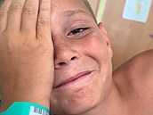 Chlapec si zasekl rybá�ský há�ek do oka. Lidé mu na TikToku vyjad�ují podporu,...