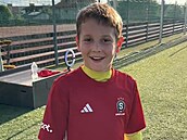 Chlapec si zasekl rybá�ský há�ek do oka. Lidé mu na TikToku vyjad�ují podporu,...