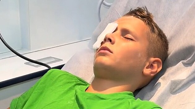 Chlapec si zasekl rybsk hek do oka. Lid mu na TikToku vyjaduj podporu, nikdo nev, zda bude v podku