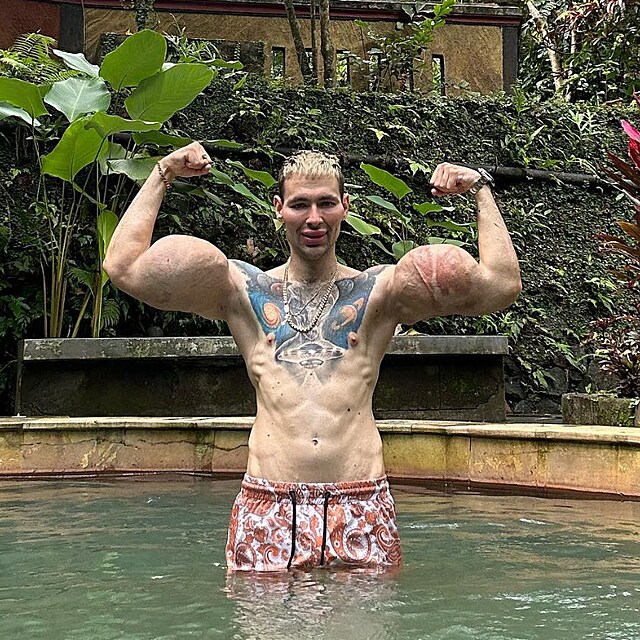 Lid si kvli popularit na socilnch stch upravuj vzhled. Podle odbornk...