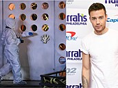Liam Payne po pádu z okna utrp�l hrozivá zran�ní, m�l prora�enou spodní �ást...