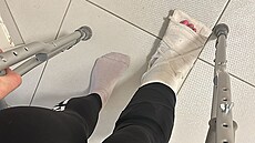 Lucie musí kv�li zran�ním pou�ívat berle.