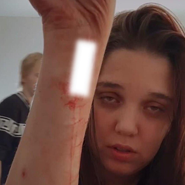 Lidé na sítích riskují život kvůli pozornosti a lajkům, dívka se dokonce podřezala. Jde o slaší osobnosti, míní psychiatr