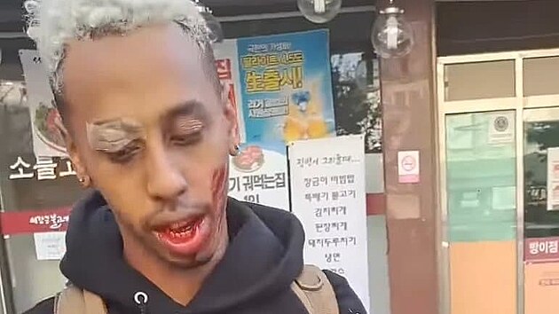 Streamerovi Johnny Somali hroz 10 let za memi.