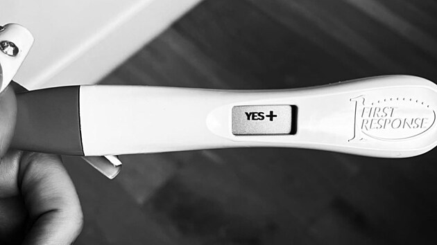 Megan Fox a Machine Gun Kelly ekaj prvnho spolenho potomka