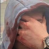 Tade� Vesel� po napaden�.