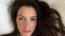 Celebrity ukázaly sv�j p�irozený vzhled