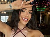 Veronica Biasiol podstoupila úpravu poprsí.